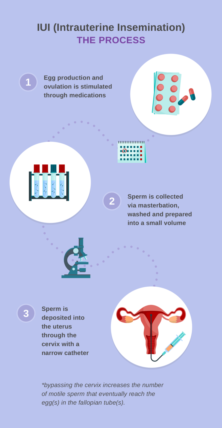 Superovulation & Intrauterine Insemination | Egg Production and Ovulation